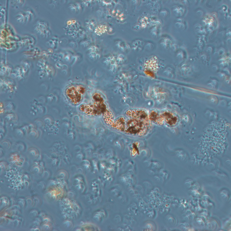 Lichtmikroskopische Aufnahme von einer Kolonie von Microcystis wesembergii (Foto: Landesagentur für Umwelt und Klimaschutz, 2019)