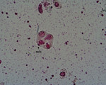 Pollentetrade von Tradescantia mit zusätzlichem, weitaus kleinerem Zellkern (MCN=Mikronucleus) -(Foto: Landesagentur für Umwelt, M. Casera, 2010)