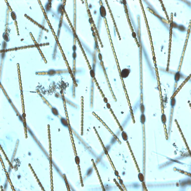 Lichtmikroskopische Aufnahme von Kolonien von Dolichospermum vigueri (Foto: Landesagentur für Umwelt und Klimaschutz, 2019)