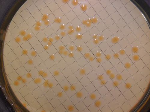 Petrischale mit auf einem Spezialnährboden gewachsenen Bakterienkolonien (Foto: Landesagentur für Umwelt, 2015)