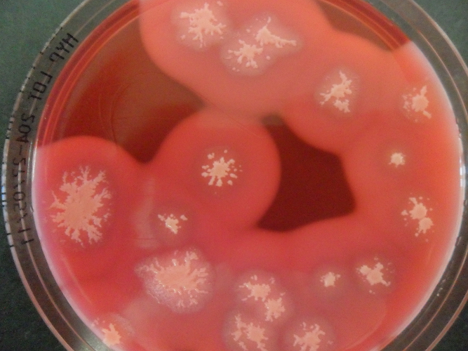Petrischale mit Bacillus cereus-Kolonien (Foto: Landesagentur für Umwelt, 2015)