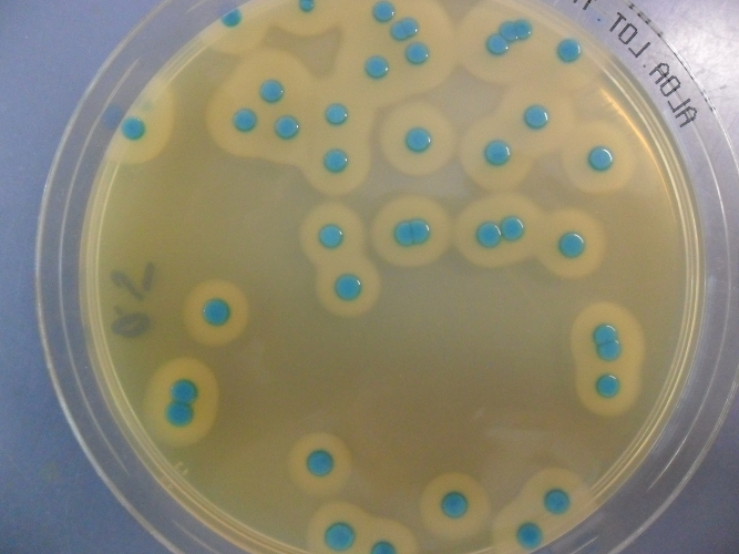 Petrischale mit Listeria monocytogenes-Kolonien (Foto: Landesagentur für Umwelt, 2015)