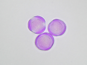 Lichtmikroskopische Aufnahme von mit Fuchsin gefärbten Beifuß-Pollen (Foto: Landesagentur für Umwelt und Klimaschutz, E. Bucher)
