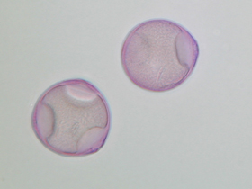 Lichtmikroskopische Aufnahme von mit Fuchsin gefärbten Pollen der Hasel (Foto: Landesagentur für Umwelt, E. Bucher, 2002)