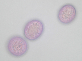 Lichtmikroskopische Aufnahme von mit Fuchsin gefärbten Pollen der Gemeinen Esche, Oberfläche mit genetztem Muster (Foto: Landesagentur für Umwelt und Klimaschutz, E. Bucher)