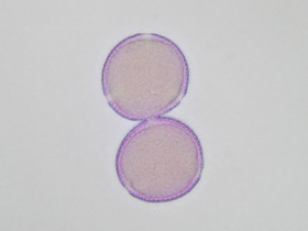 lichtmikroskopische Aufnahme von mit Fuchsin gefärbten Pollen der Gemeinen Esche - Pollen im optischen Schnitt (Foto: Landesagentur für Umwelt, E. Bucher, 2002)