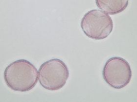 lichtmikroskopische Aufnahme von mit Fuchsin gefärbten Pollen der Manna-Esche (Foto: Landesagentur für Umwelt, E. Bucher, 2002)