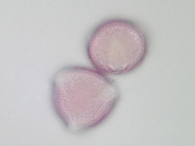 Lichtmikroskopische Aufnahme von mit Fuchsin gefärbten Pollen der Flaum-Eiche; Oberflächenansicht (Foto: Landesagentur für Umwelt und Klimaschutz, E. Bucher)