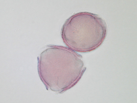 lichtmikroskopische Aufnahme von mit Fuchsin gefärbten Pollen der Flaum-Eiche - Pollen im optischen Schnitt (Foto: Landesagentur für Umwelt, E. Bucher, 2002)