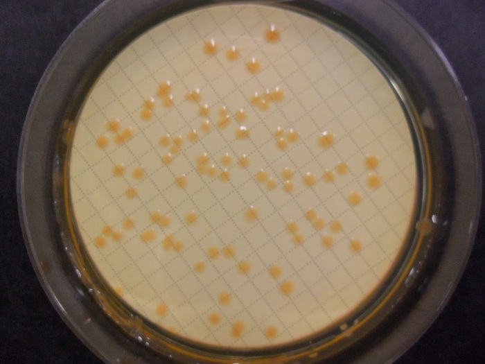 Mikrobiologische Untersuchung: Coliforme Keime im Wasser; Petrischale mit Kolonien von Coliforme-Keimen (Foto: Landesagentur für Umwelt)