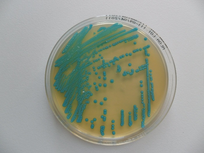 Mikrobiologische Untersuchung: Listeria in Lebensmitteln; Petrischale mit Listeria monocytogenes-Kolonien (Foto: Landesagentur für Umwelt)
